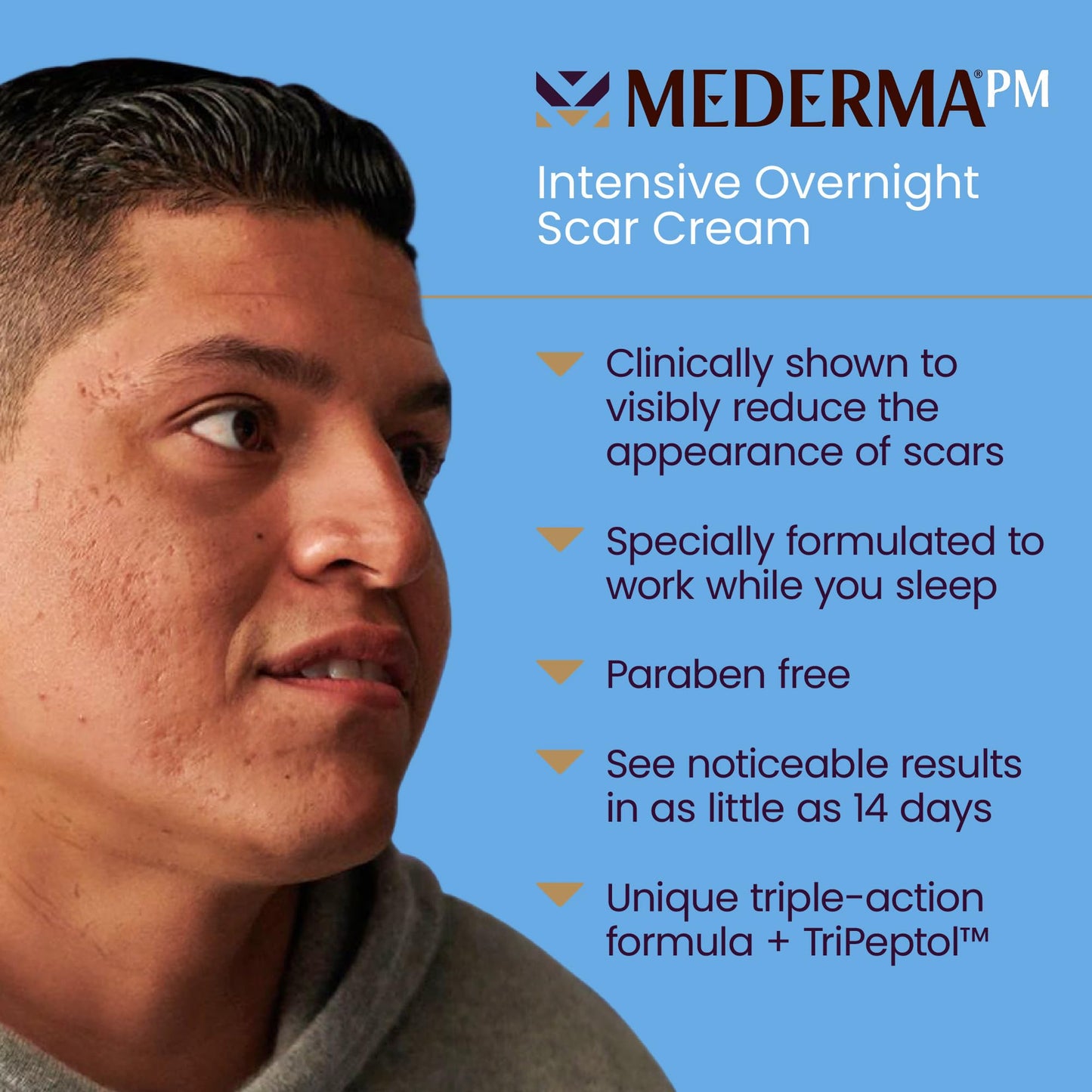 Mederma PM Scar Cream tube for overnight scar repair, reduces appearance of surgery, acne, and injury scars while you sleep