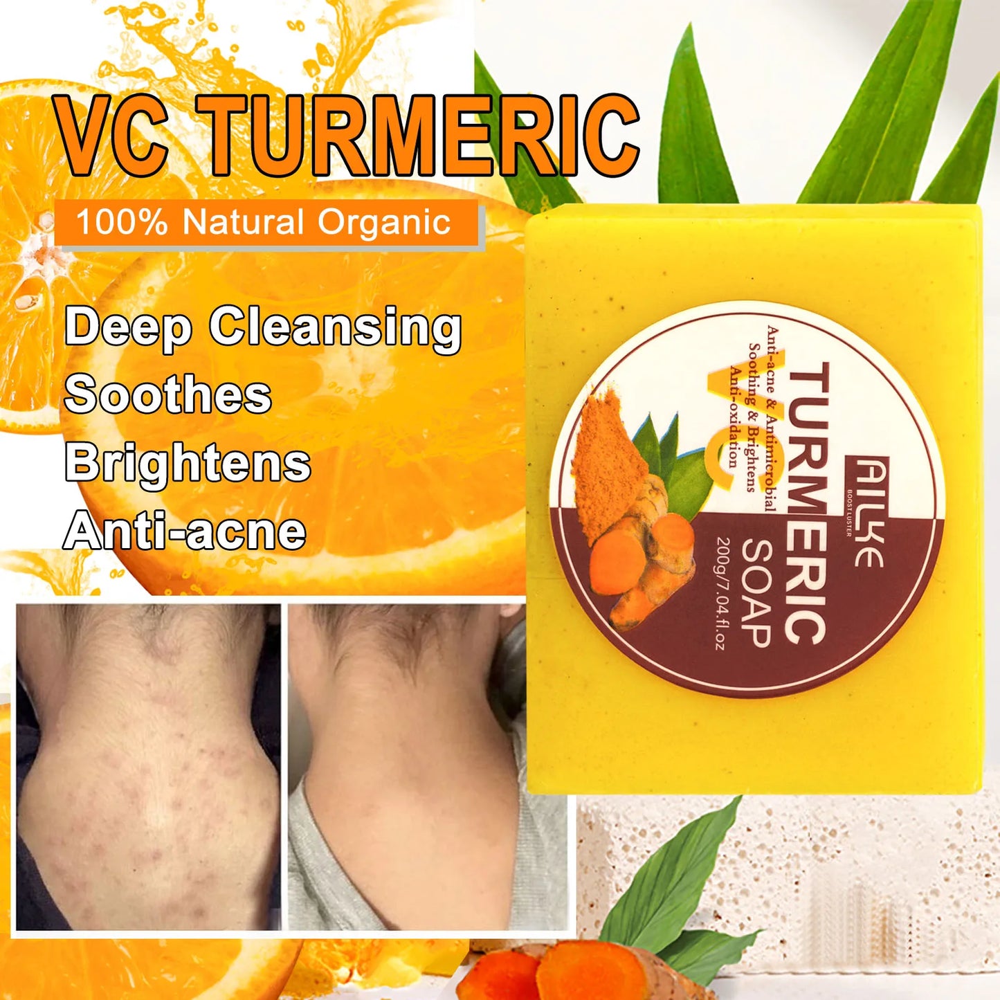 Organic Turmeric Skin Care Kit – Brightening, Hydrating, Exfoliating & Even Tone Solution | Naturally You Balance