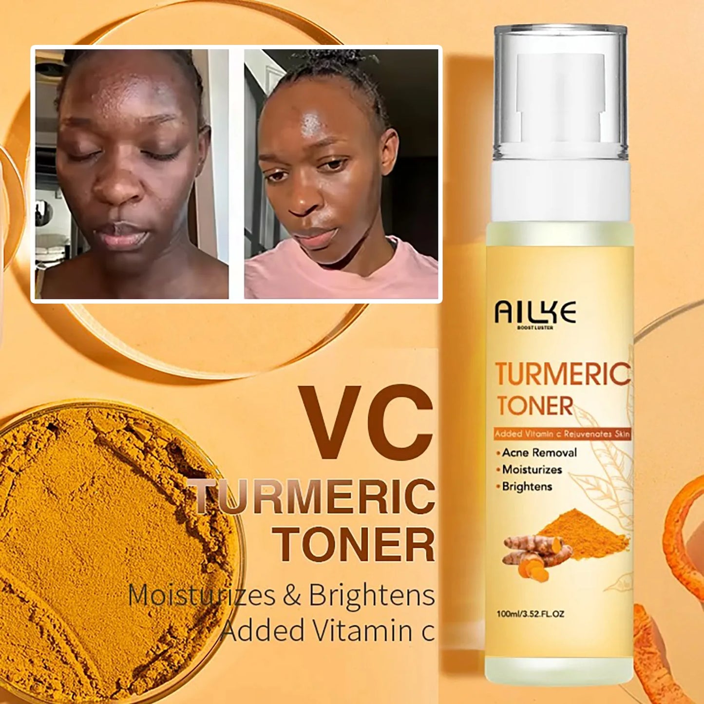 Organic Turmeric Skin Care Kit – Brightening, Hydrating, Exfoliating & Even Tone Solution | Naturally You Balance