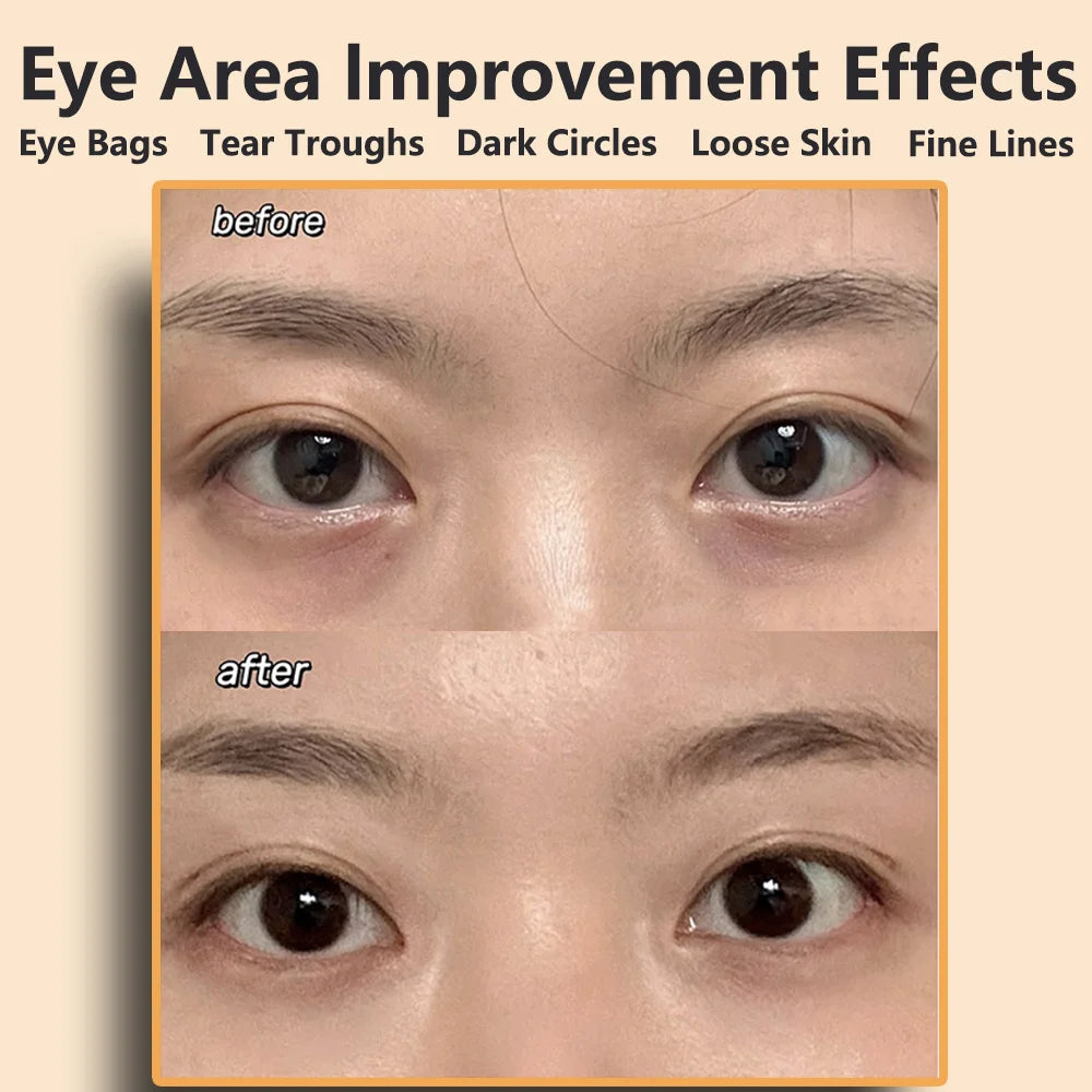 EMS Eye Massager – Microcurrent Beauty Tool for Dark Circles, Skin Tightening & Under-Eye Lift | Naturally You Balance