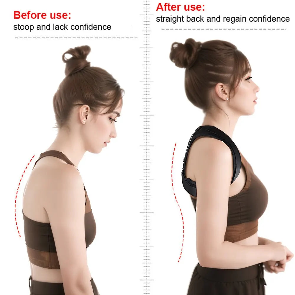 Adjustable Posture Corrector – Clavicle, Neck & Shoulder Support for Pain Relief | Naturally You Balance