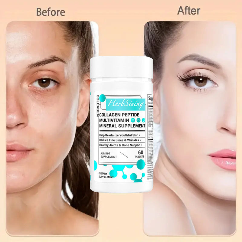 Collagen Peptides – Biotin + Beauty Vitamins
Supports radiant skin, hair, nails & joint wellness in 60 clean capsules.