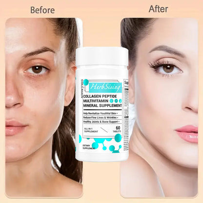 Collagen Peptides – Biotin + Beauty Vitamins
Supports radiant skin, hair, nails & joint wellness in 60 clean capsules.
